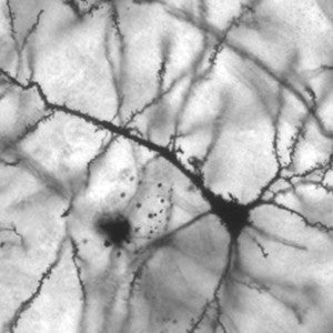 Image of a pyramidal neuron from an electron microscope. This is the image used in the pendant.